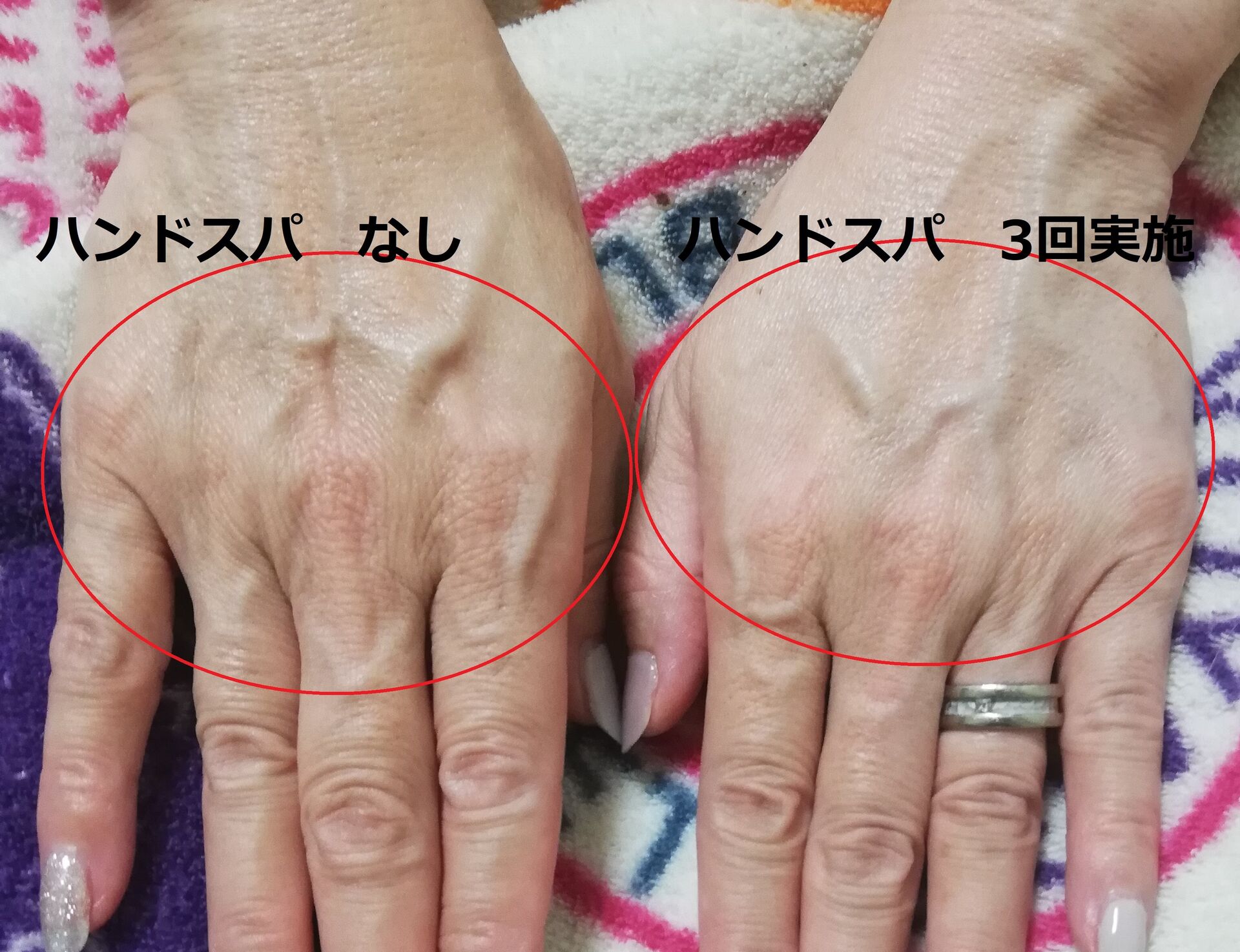 ビフォーアフター